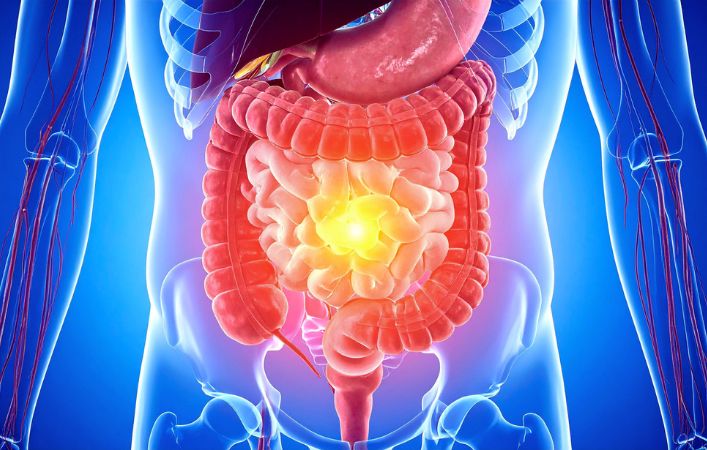 Colon.jpg