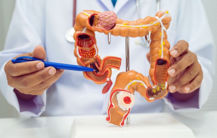 colonoscopy.jpg