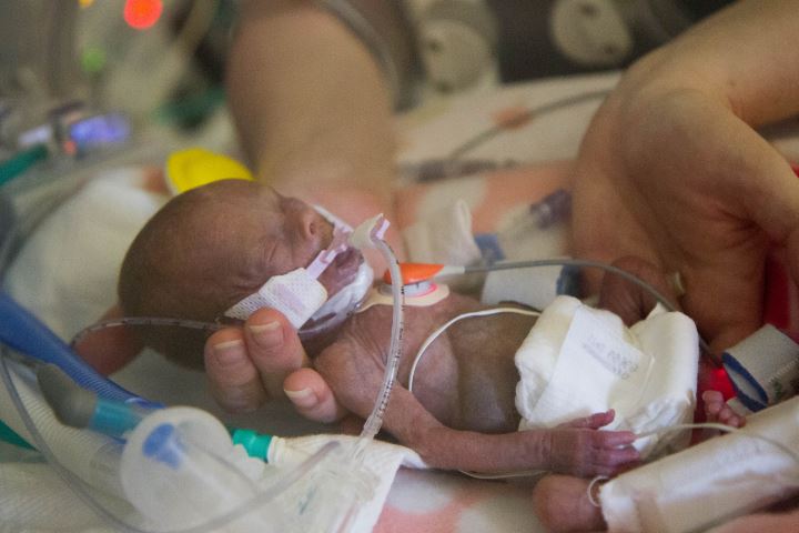 Ces Quatre Bebes Prouvent Que Les Enfants Nes Tres Prematurement Peuvent Survivre Campagne Quebec Vie