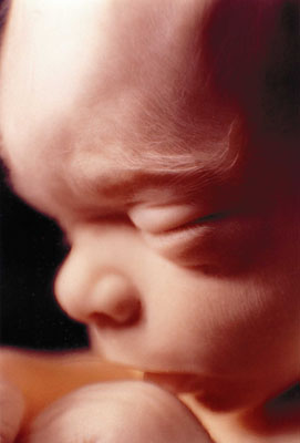 unbornbaby20w-01-1.jpg