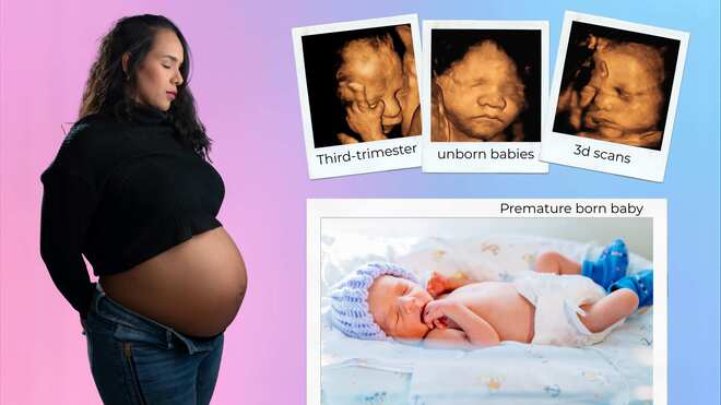 Baby loss awareness and abortion decrim: Is it a baby or isn’t it?