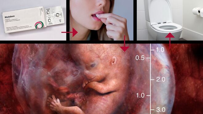 Is Abortion Healthcare?