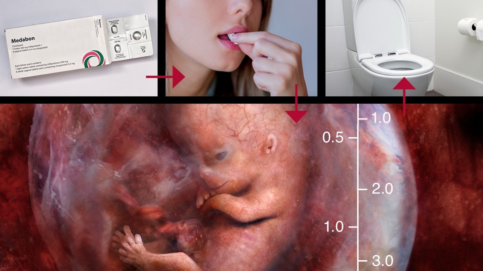Is Abortion Healthcare?