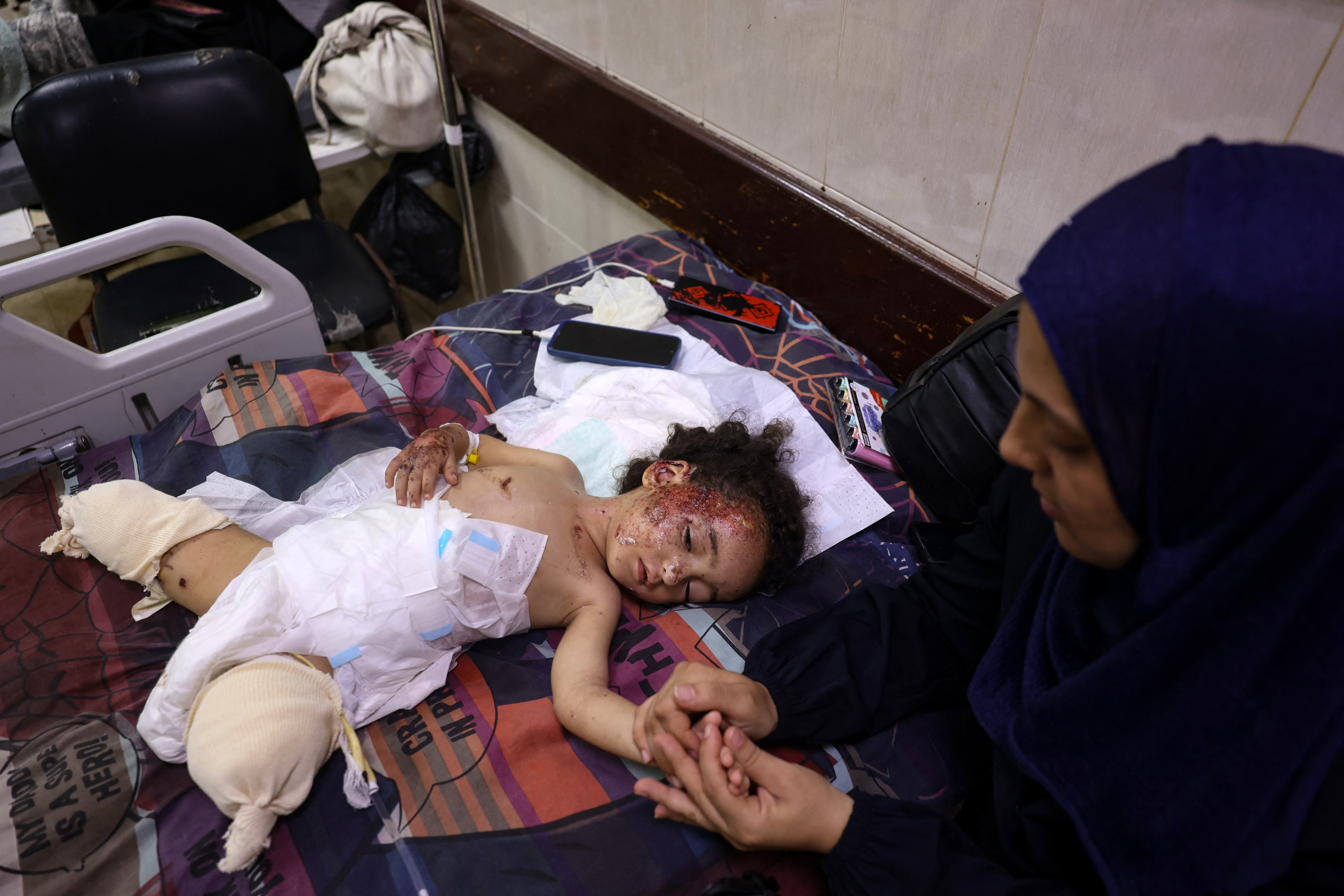An aunt [Shifa] tries to comfort Palestinian child Hanan, at the Al-Aqsa Martyrs hospital in Deir al-Balah in the central Gaza Strip on September 8, 2024. (Photo by Eyad Baba / AFP)