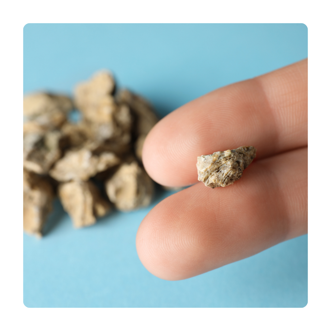 KN_02_stones.png