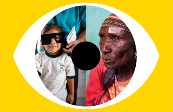 World Health Organisation (WHO) - World Report on Vision preview image