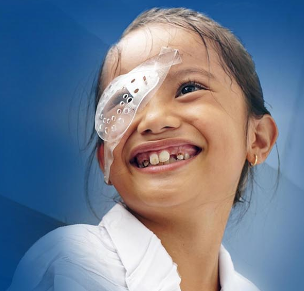 Girl with eye patch smiling (IABP)