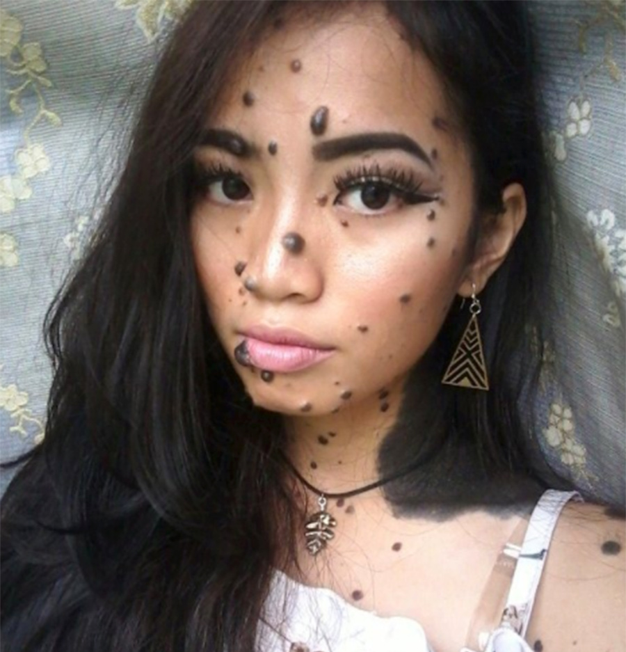 girl with unique condition