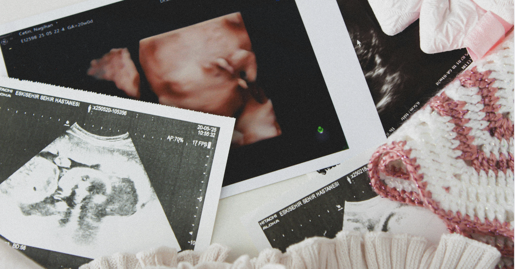 The cruel reality of ‘abortion on demand’