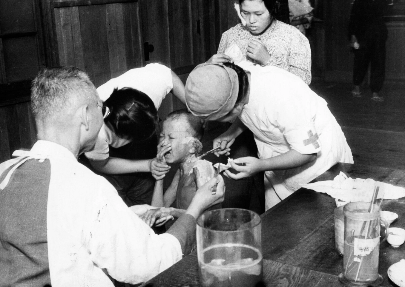 Uma criança recebe tratamento para queimaduras após o bombardeio nuclear americano de Nagasaki em 1945. Crédito: Yasuo Tomishige