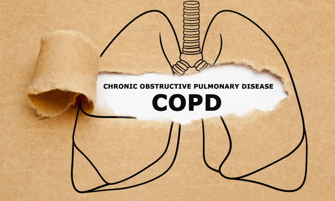 COPD stand for